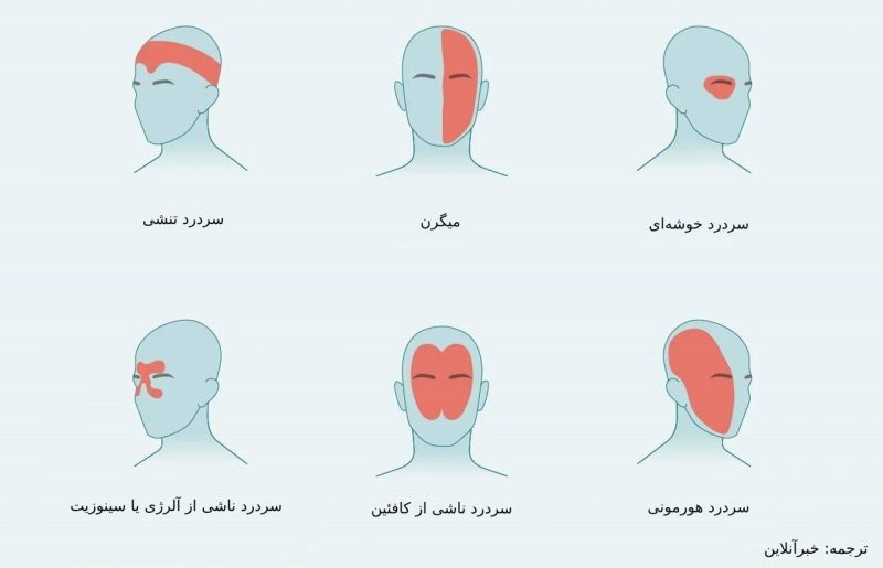 درد در نواحی مختلف سر ناشی از چیست؟/ از سردرد خوشه‌ای تا سردرد رعد و برقی+ تصاویر