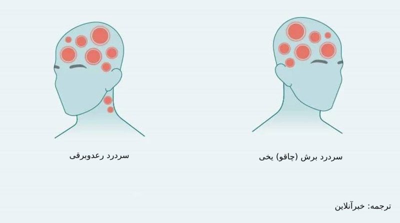 درد در نواحی مختلف سر ناشی از چیست؟/ از سردرد خوشه‌ای تا سردرد رعد و برقی+ تصاویر